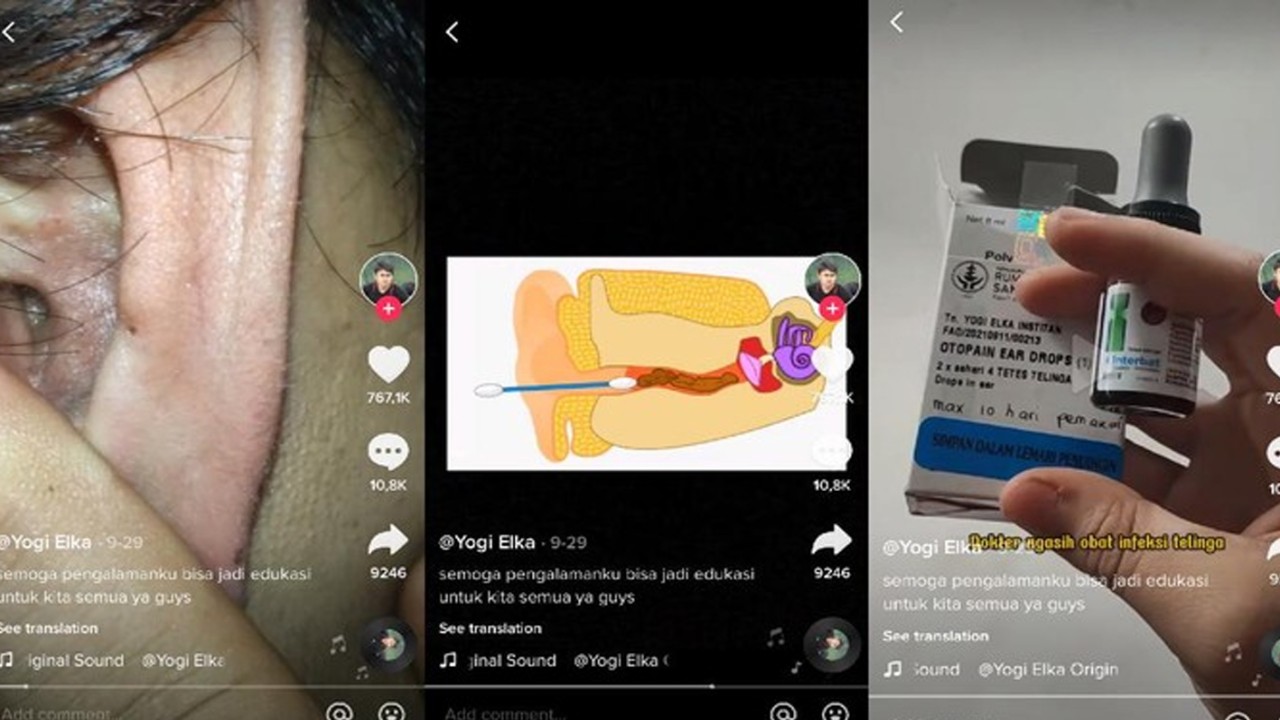 Foto: Tangkapan layar konten Tiktok Yogi Elka (@yogielka) atas izin yang bersangkutan.