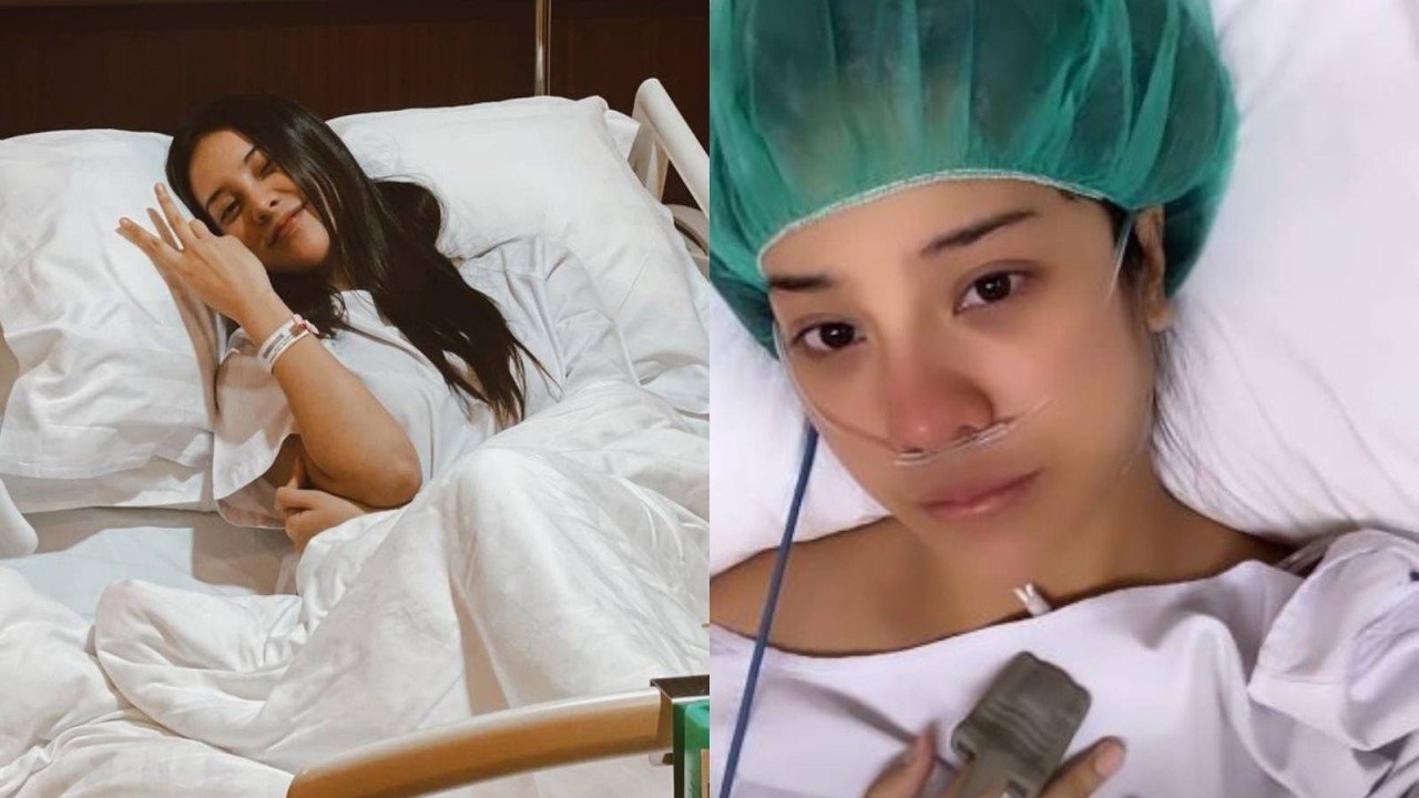 Anya Geraldine sebelum dan sesudah operasi/ist