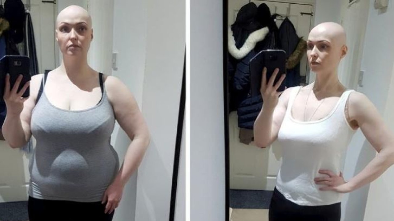 Brenda Finn berhasil menurunkan berat badannya setelah menghapus medsos miliknya. (India Times)