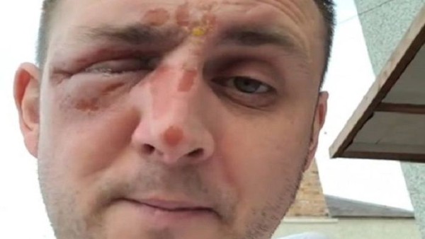 Insiden Mengerikan-1636951928