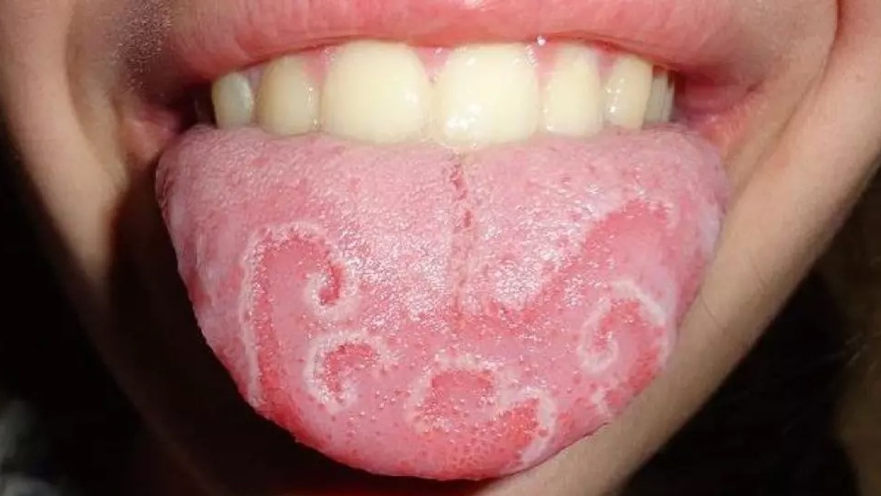 Lidah geografis (commons.wikimedia.org)