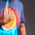 Ilustrasi kondisi penderita GERD-1644590244