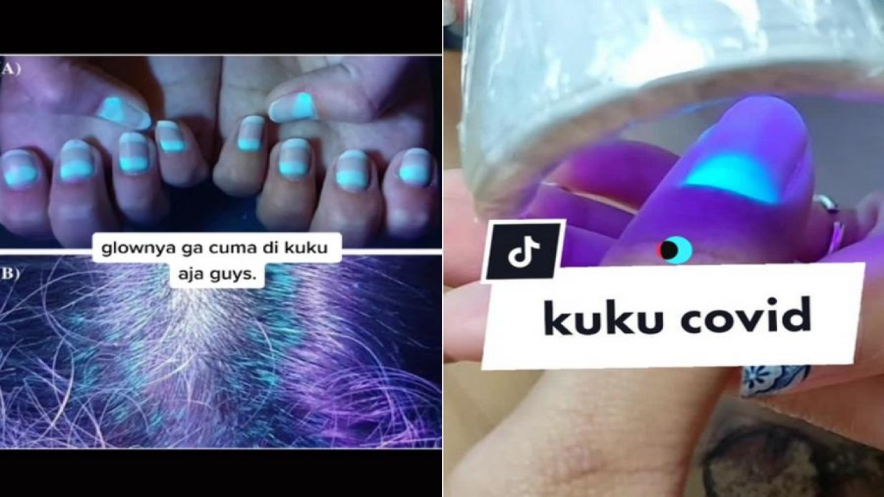 Kuku penyintas covid-19 menyala saat disinari UV/ist