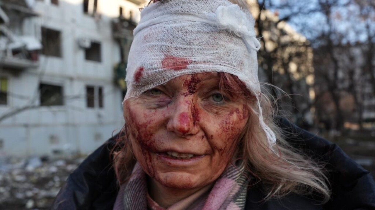 Warga Ukraina korban perang. (Skynews)