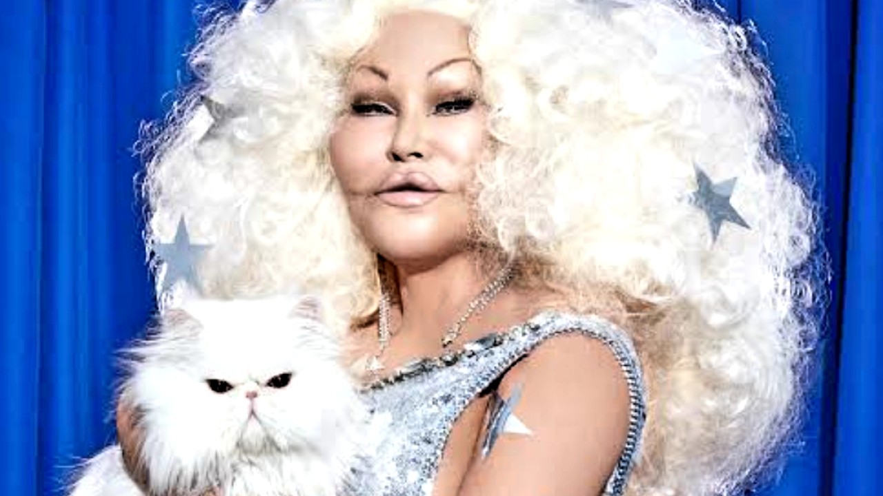 Sosialita Jocelyn Wildenstein wajahnya seperti kucing setelah gagal oplas/net