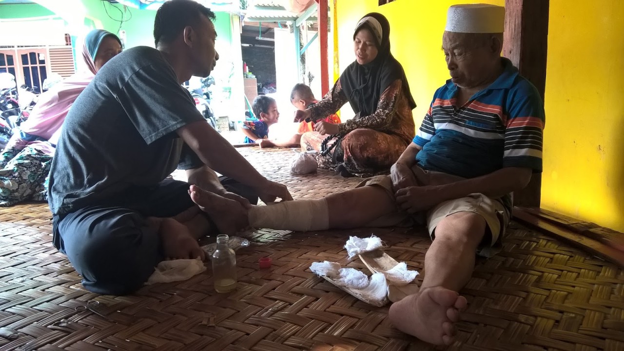 Masih banyak masyarakat yang memilih berobat ke dukun tulang ketika mengalami kejadian patah tulang/ist