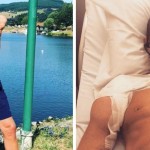 Felix Gretarsson sukses menjalani transplantasi dua lengan-1653810366