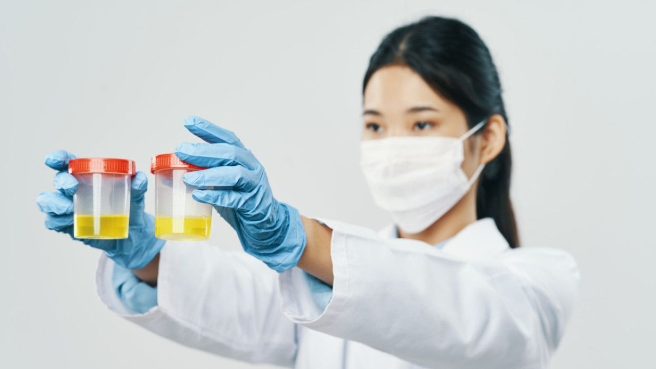 Ilustrasi air seni/ist