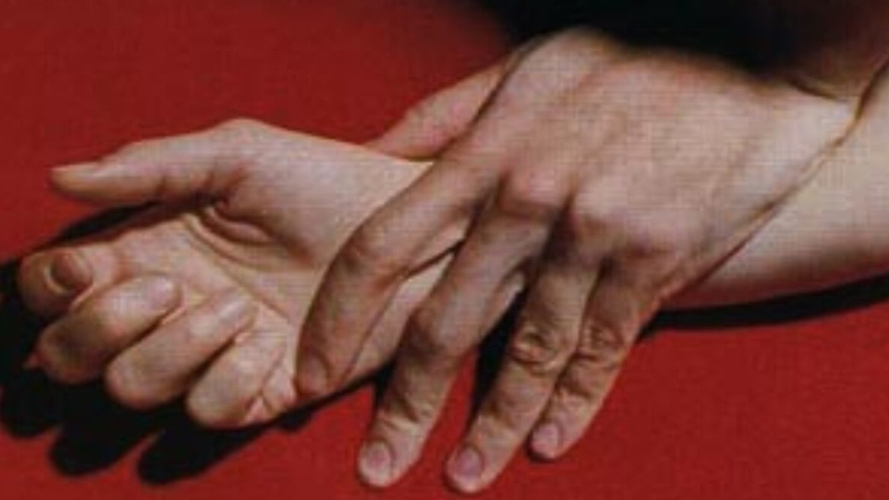 Ilustrasi Pemerkosaan. Ist