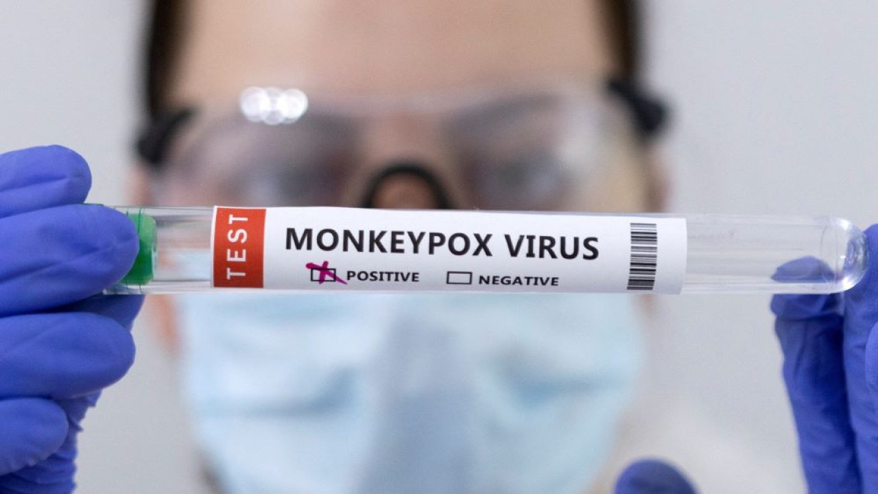 Ilustrasi. Tabung reaksi berlabel 'positif cacar monyet'. (Reuters)