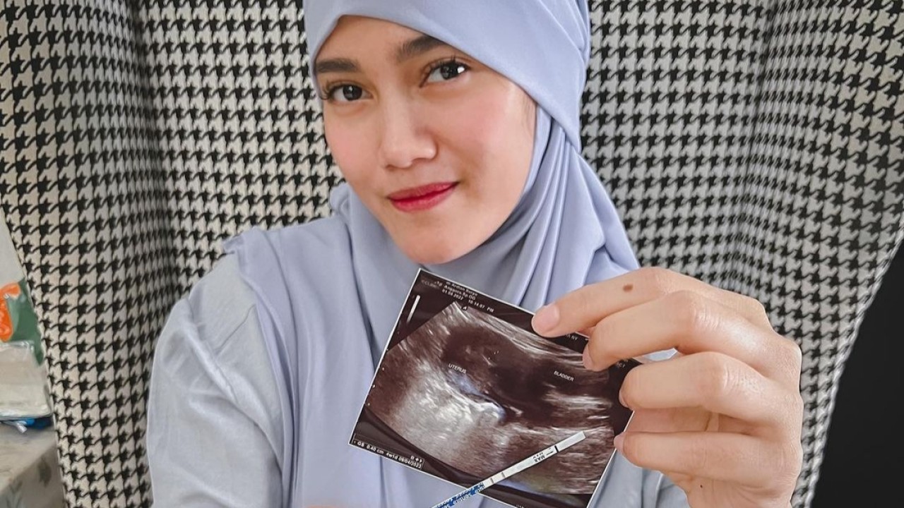 Jessie Amalia/Instagram