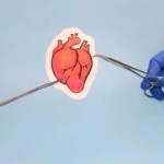 Ilustrasi transplantasi jantung (ANTARA/Shutterstock/Soloveva Anastasiia)-1667908944