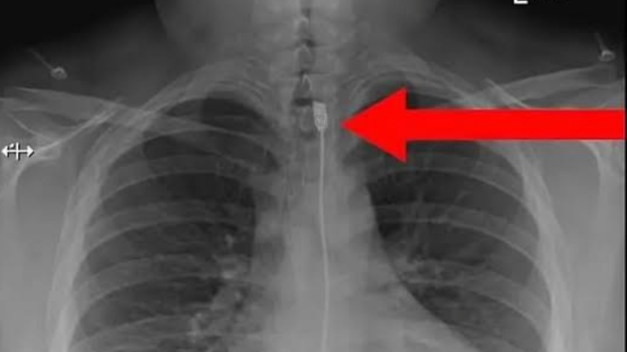 Wanita Polandia gemar makan kabel charge/net