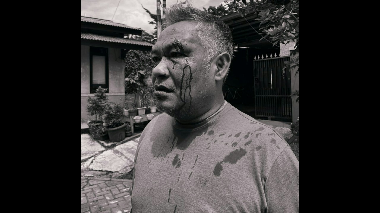 Korban dugaan penganiayaan oknum prajurit TNI AU. (Net)