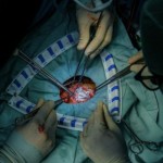 Ilustrasi - Dokter spesialis saat melakukan operasi. ANTARA/HO-Kemenkes-1676340063