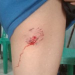 Luka korban akibat gigitan anjing rabies di Dompu, NTB (ANTARA/Humas Polres Dompu)-1679202151