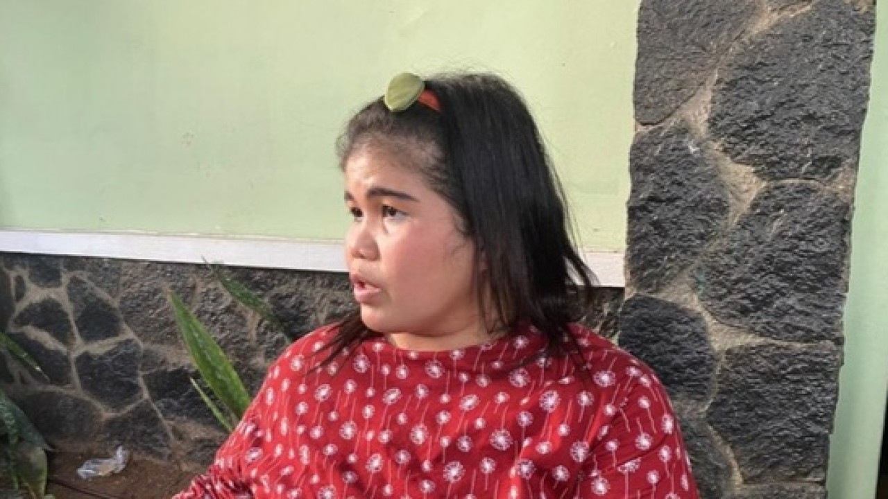 Nisa, korban pencopetan di acara pengobatan Ibu Ida Dayak. (Detikcom)