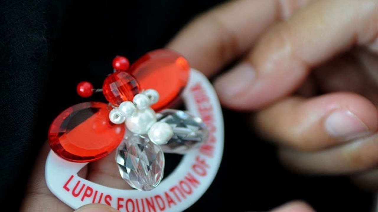 Dokumentasi. Panitia memegang pin lupus saat memperingati Hari Lupus Sedunia yang jatuh pada 10 Mei di Jakarta, Jumat (7/5/2010). FOTO ANTARA/Rosa Panggabean/pd/aa.