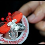 Pendekatan presisi penakluk penyakit lupus-1683625323