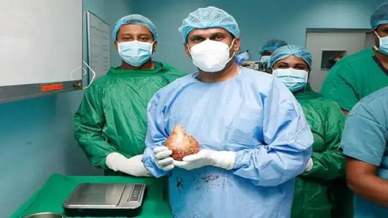 Dokter militer di Sri Lanka sukses mengeluarkan batu ginjal yang memiliki ukuran terbesar dalam sejarah medis. (Guinness World Records)