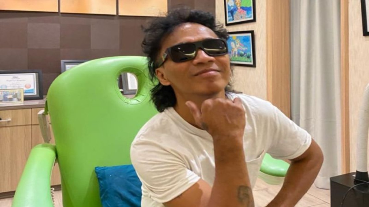 Kaka Slank percaya diri usai jalani transplantasi rambut (ANTARA/HO-Farmanina Aesthetic & Hair Clinic)