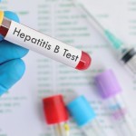 Hepatitis-1690615766