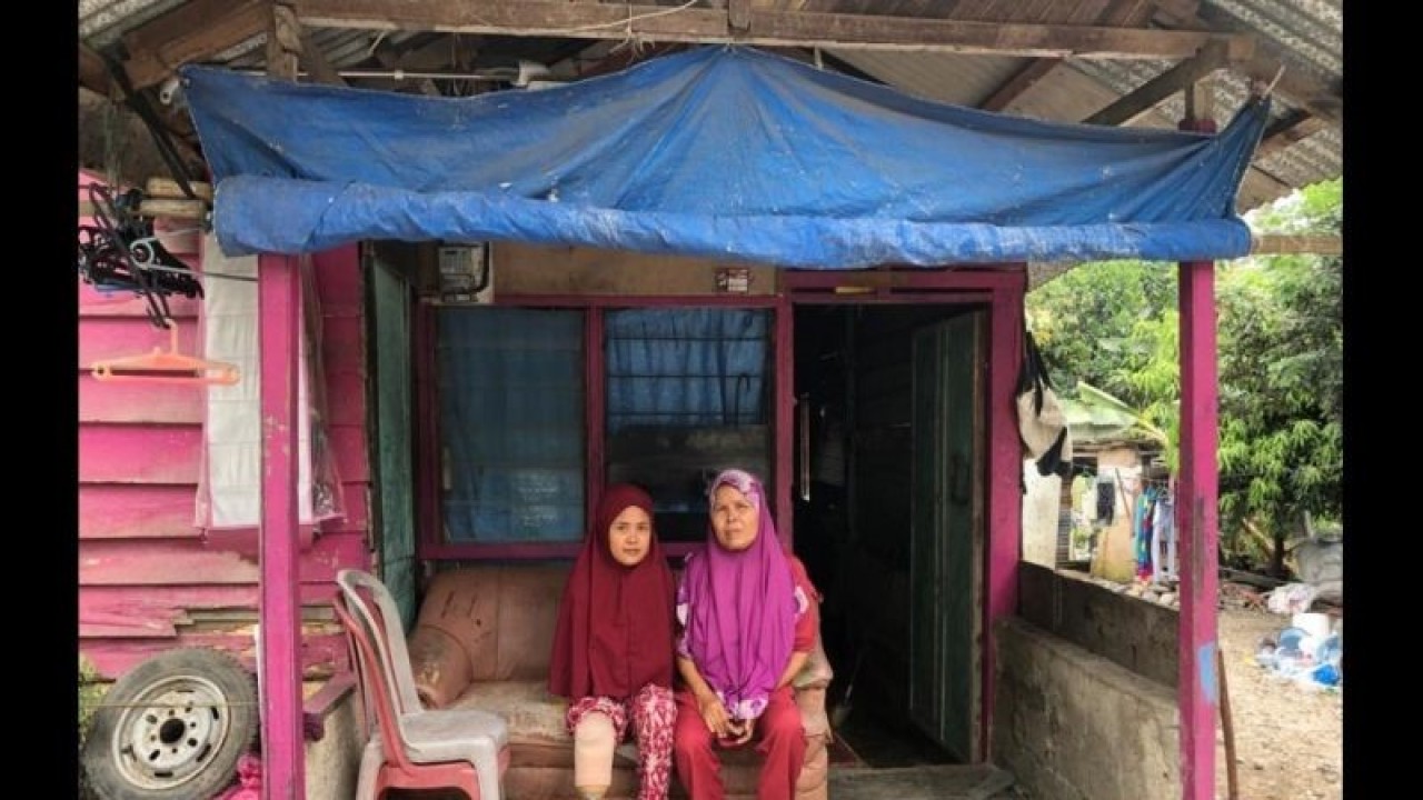 Susmayeni (kiri) penerima manfaat berupa bantuan kaki palsu dari Semen Padang. (ANTARA/HO/Humas Semen Padang).
