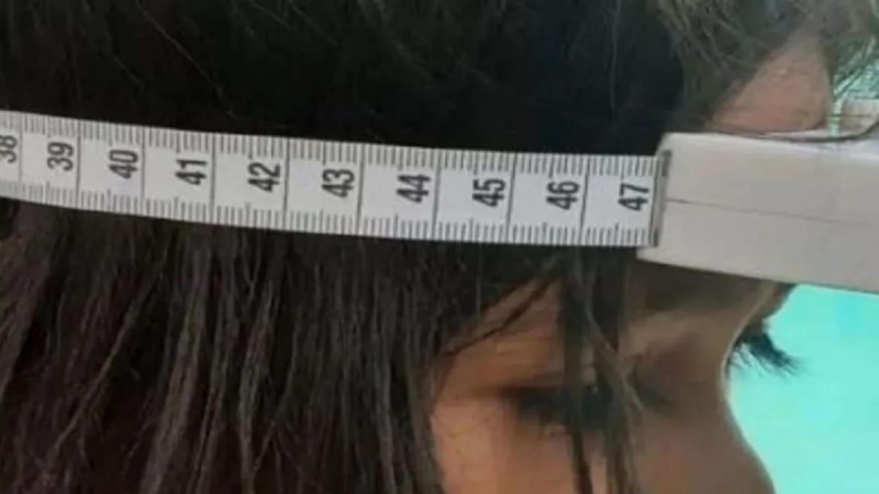 Ilustrasi - Pengukuran lingkar kepala anak di NTT. (ANTARA/HO-Pemkab Manggarai Barat)