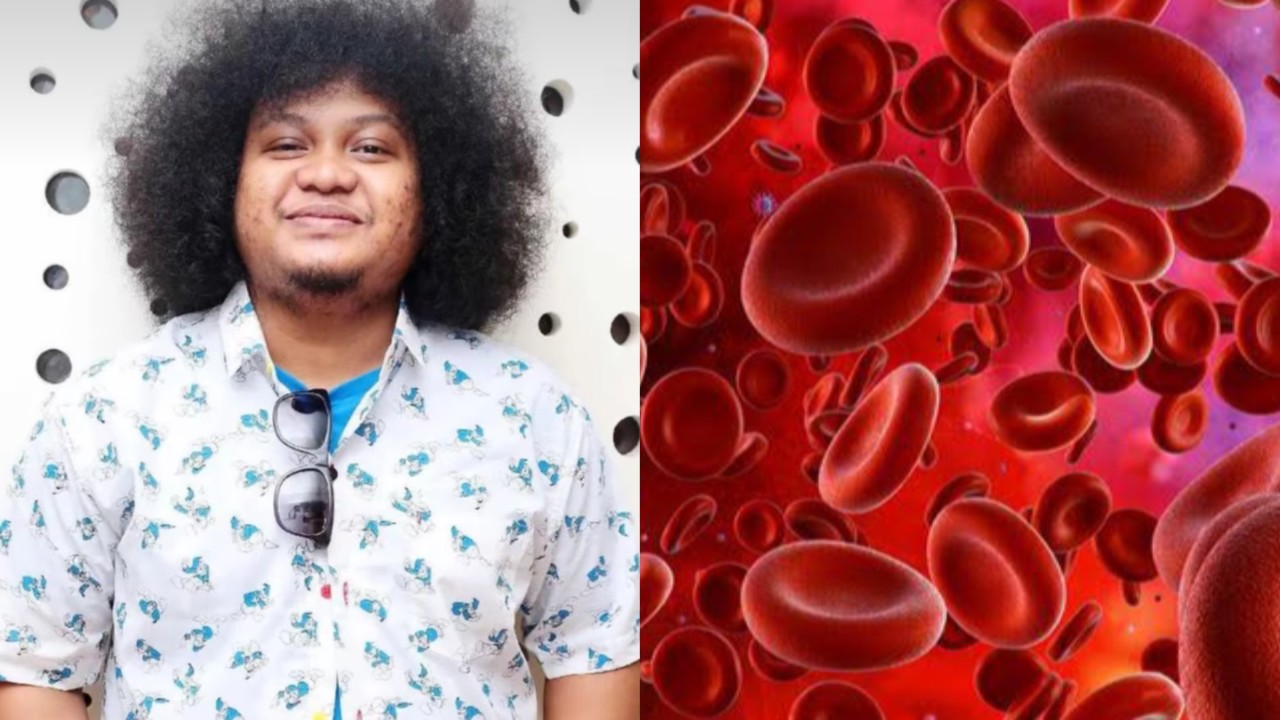 Anemia Aplastic (Instagram)