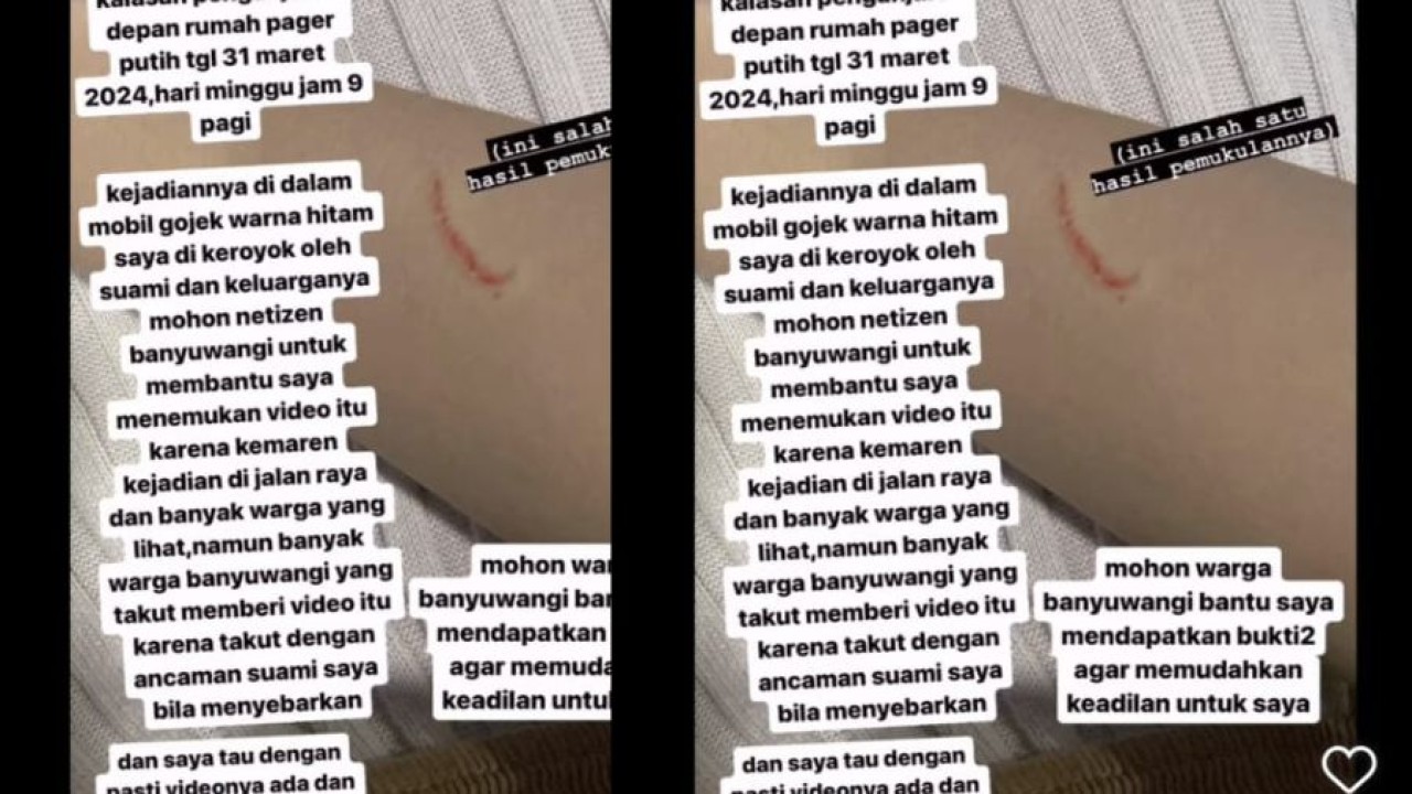 wanita di Banyuwangi ngaku alami KDRT (Instagram @sharonmilan)