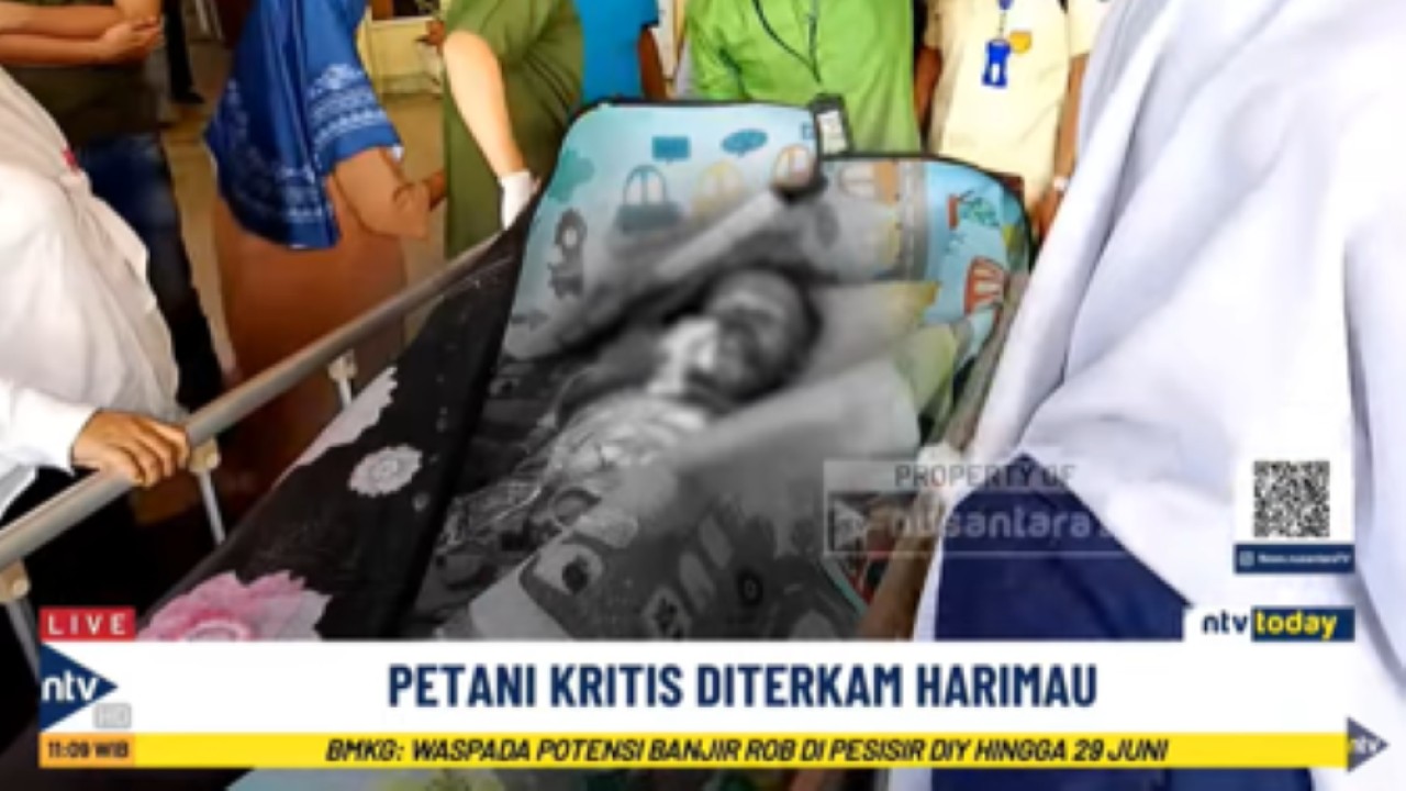 Ramli seorang petani kopi di Jambi terluka parah di sekujur tubuh akibat diserang dua ekor harimau